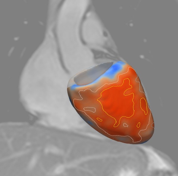 Британские ученые создали 3D-карту сердца